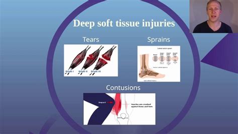 how to test for soft tissue damage|soft tissue injury prognosis.